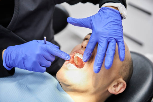 Best Emergency Gum Pain Relief  in Pine Knot, KY